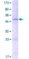 Human FOLR3 Protein (Recombinant GST)