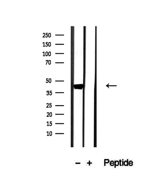 OXA1L / OXA1 Antibody