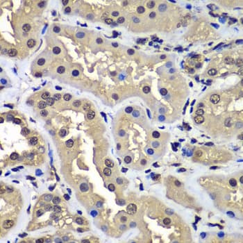 CCAR2 / KIAA1967 Antibody