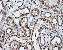 Monoclonal Mouse anti-Human NPR3 Antibody (clone OTI11B6, IHC, IF, WB)