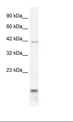 P2RX6 / P2X6 Antibody (aa66-115)