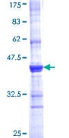 Human ACE / CD143 Protein (Recombinant GST, N-terminus)