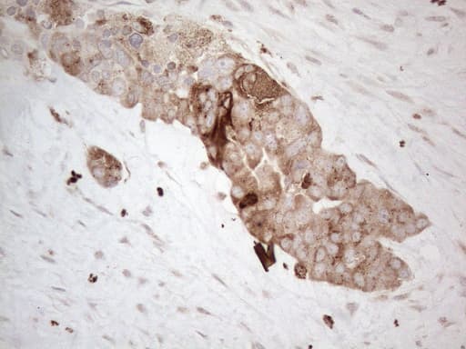 GRN / Granulin Antibody (aa327-593, clone OTI3B3)