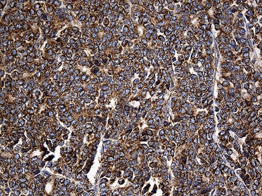 Monoclonal Mouse anti-Human CYP7B1 Antibody (clone OTI1G7, aa263-506, IHC, WB)