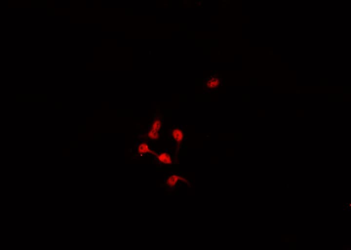 Polyclonal Rabbit anti-Human DLC1 Antibody (IHC, IF, WB)