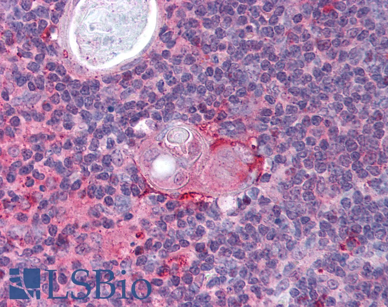 IHC-plus™ Polyclonal Chicken anti-Human IKBKB / IKK2 / IKK Beta Antibody (aa310-376, IHC, WB)