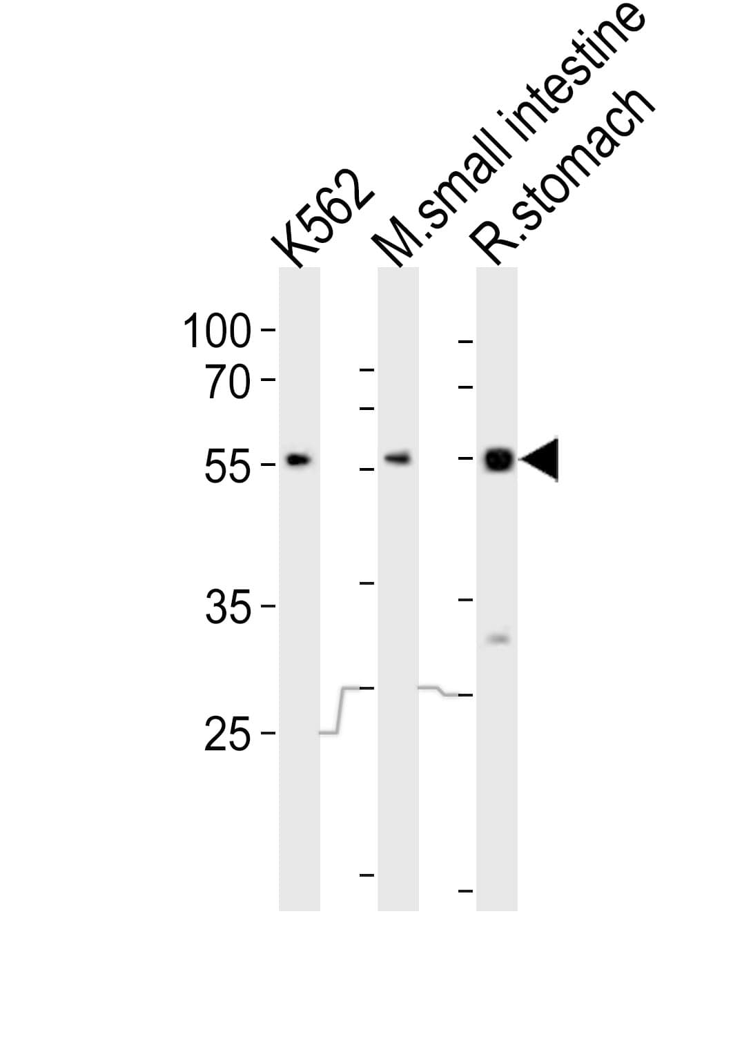 FRK Antibody (aa482-516)