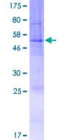 Human SLC35E4 Protein (Recombinant GST)