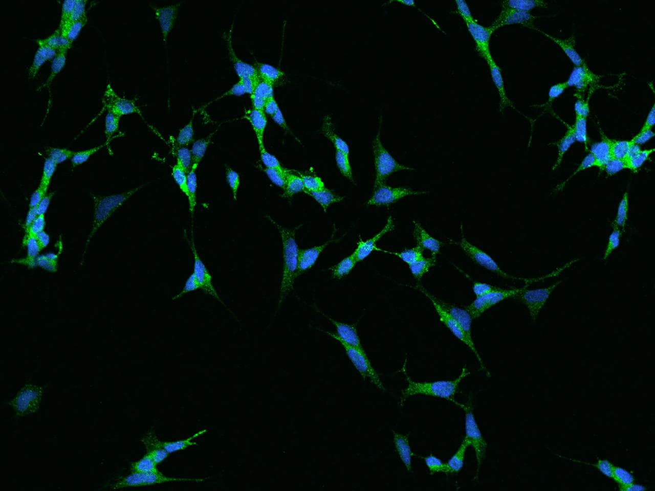 Polyclonal Rabbit anti-Human CHGB / Chromogranin B Antibody (IF)