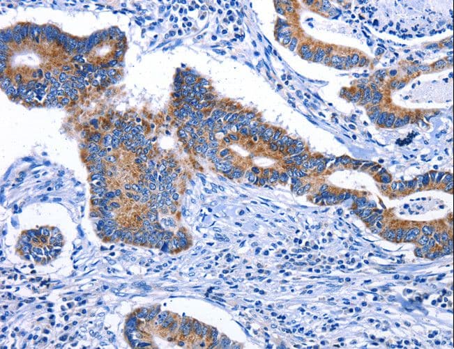 STAT5A Antibody