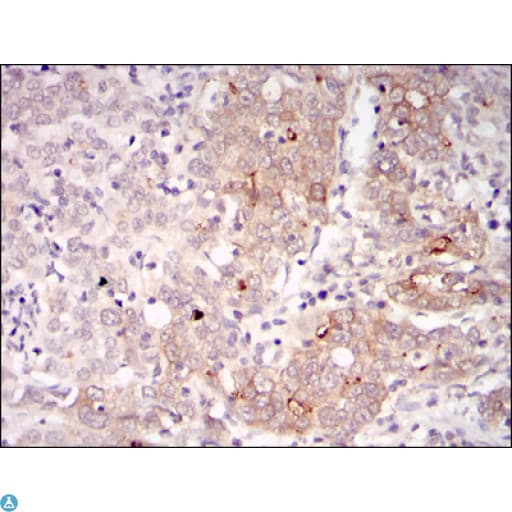 BLNK Antibody