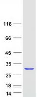 Human RAB2B Protein (Recombinant Myc-DDK (Flag))