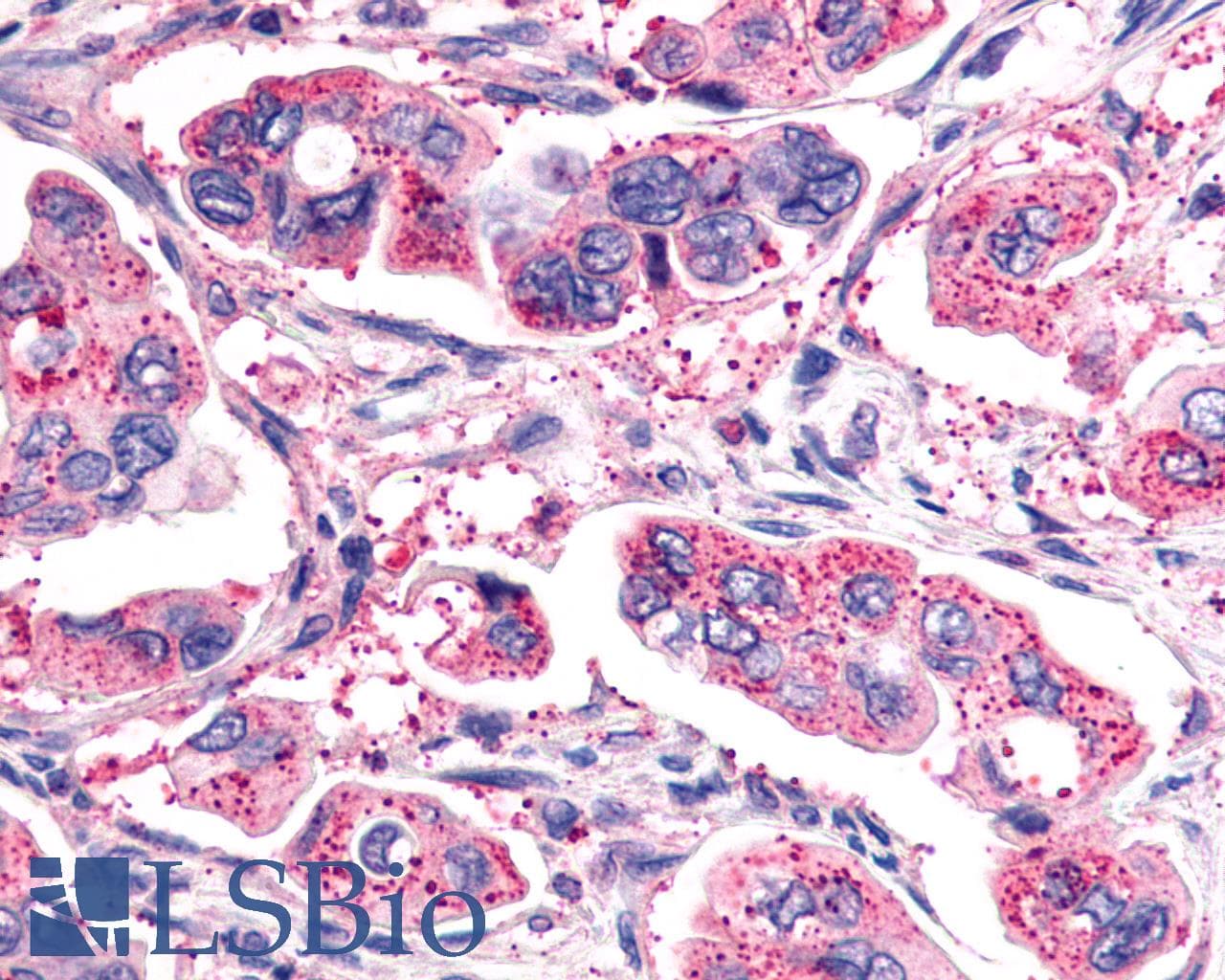 IHC-plus™ Polyclonal Rabbit anti-Human GHRHR Antibody (C-Terminus, IHC)