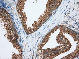 Monoclonal Mouse anti-Human PDE4A / PDE4 Antibody (clone OTI2G2, IHC, IF, WB)