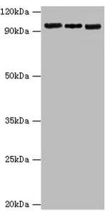 Polyclonal Rabbit anti-Human CLOCK Antibody (aa577-846, IHC, WB)