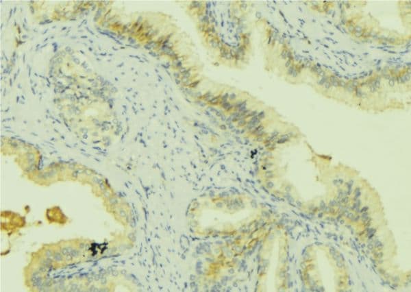 PRSS8 / Prostasin Antibody