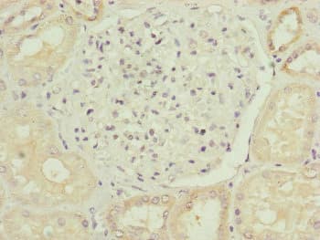 TRIM1 / MID2 Antibody