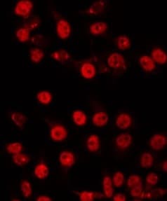 ZNF682 Antibody
