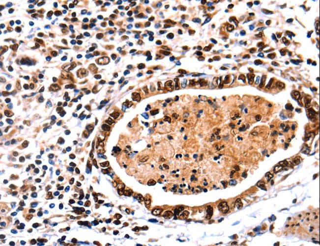 DNMT3A Antibody