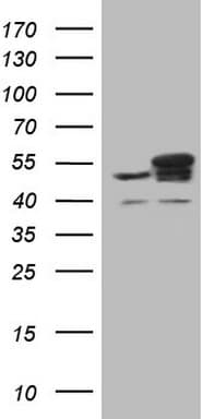 Monoclonal Mouse anti-Human YBX1 / YB1 Antibody (clone OTI11A7, IHC, WB)