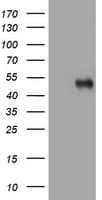 SPN / CD43 Antibody (clone OTI3D11)
