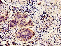 HIPK3 / FIST Antibody