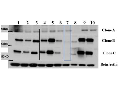 AKT3 Antibody (Internal, clone 25F6.F6.D8, RPE)