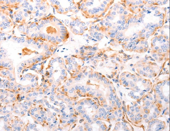 ABCA4 Antibody