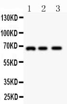 GAD1 / GAD67 Antibody (aa14-122)