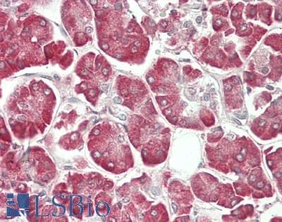 IHC-plus™ NXP2 / MORC3 Antibody (aa634-663)