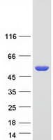 Human ALDH3A1 Protein (Recombinant Myc-DDK (Flag))