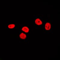 Polyclonal Rabbit anti-Human SOX9 Antibody (Internal, IHC, IF, WB)