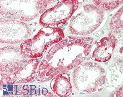 IHC-plus™ D52 / TPD52 Antibody (aa100-132)