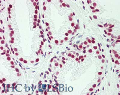 Polyclonal Rabbit anti-Human CENPU / MLF1IP Antibody (IHC, WB)