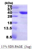 Human ASPA Protein (Recombinant 6His, N-terminus)