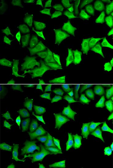Polyclonal Rabbit anti-Human RPS12 / Ribosomal Protein S12 Antibody (IHC, IF, WB)