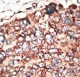 MMP17 Antibody (aa391-420)