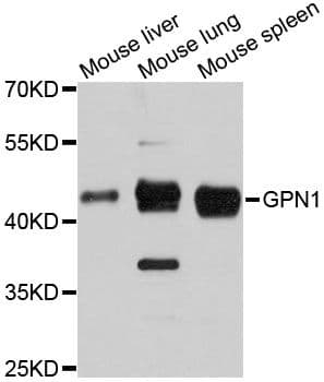 Polyclonal Rabbit anti-Human GPN1 / XAB1 Antibody (WB)