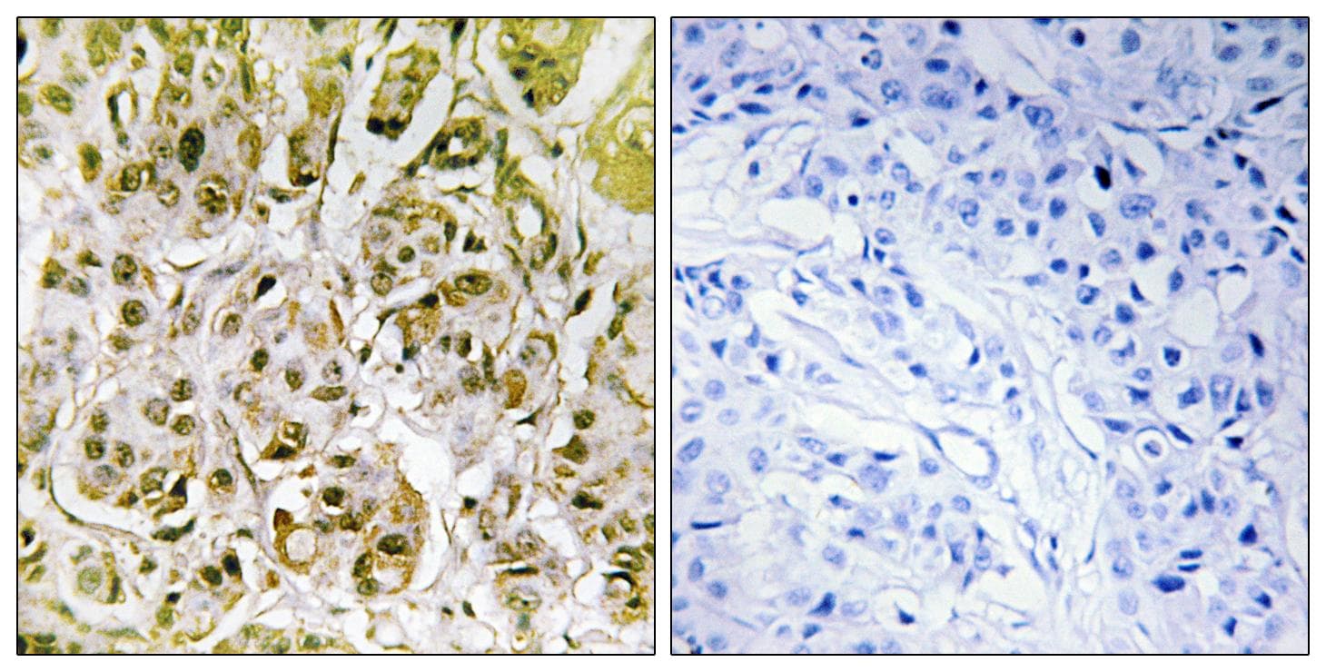 Polyclonal Rabbit anti-Human SMAD1 Antibody (phospho-Ser187, IHC, WB)