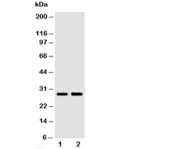 SSX2 Antibody (aa47-74)