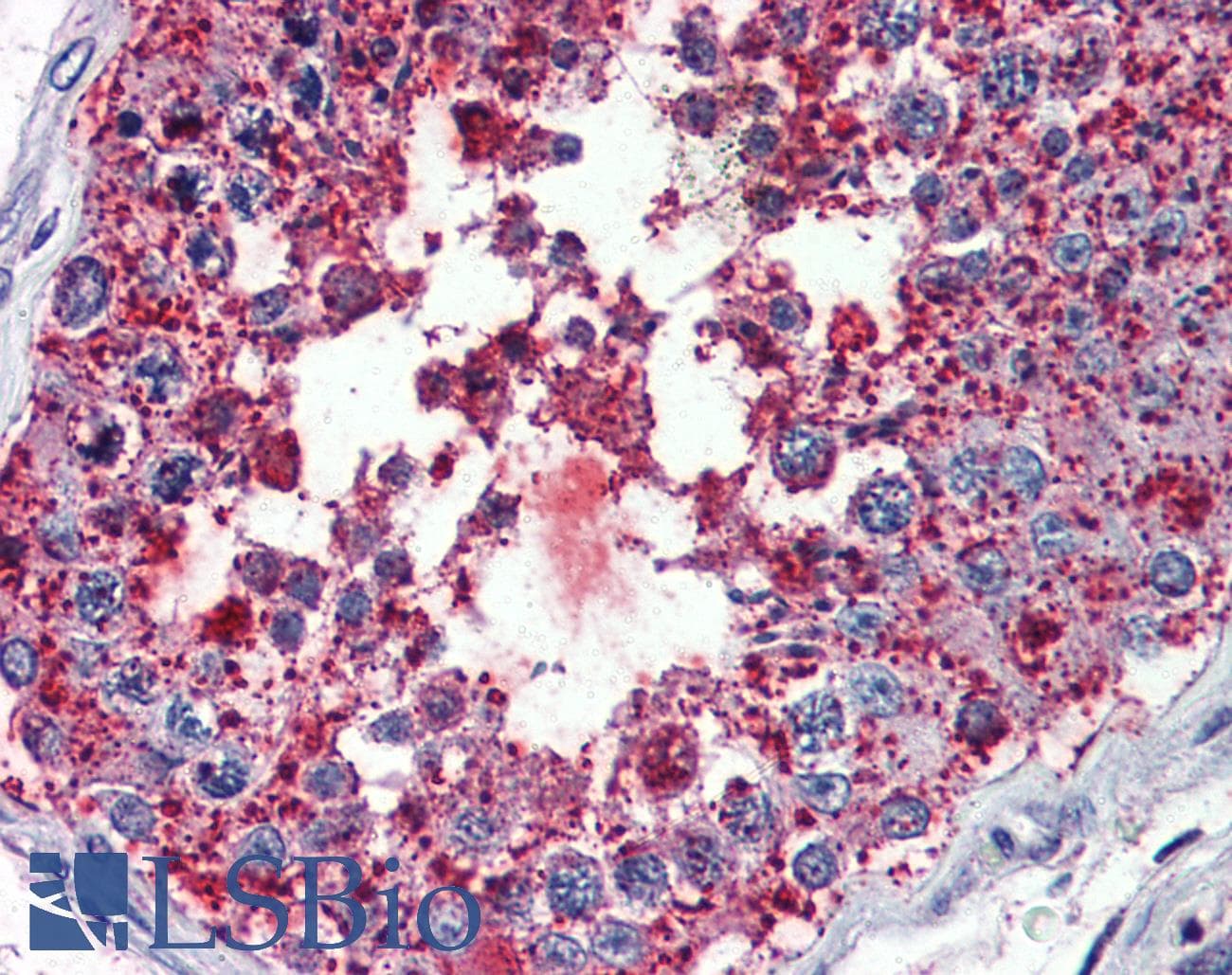 IHC-plus™ Polyclonal Rabbit anti-Human VMD2L3 / BEST3 Antibody (Cytoplasmic Domain, IHC)