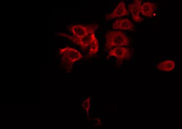 MAP3K5 / ASK1 Antibody (phospho-Ser83)