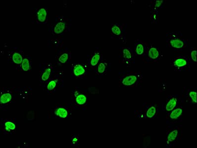 Polyclonal Rabbit anti-Human HIST1H2BB Antibody (IF)