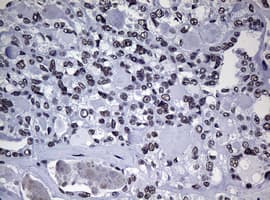 NBN / Nibrin Antibody (aa183-460, clone OTI3C12, Carrier-free)