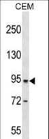 Polyclonal Rabbit anti-Human DPP4 / CD26 Antibody (aa357-384, WB)