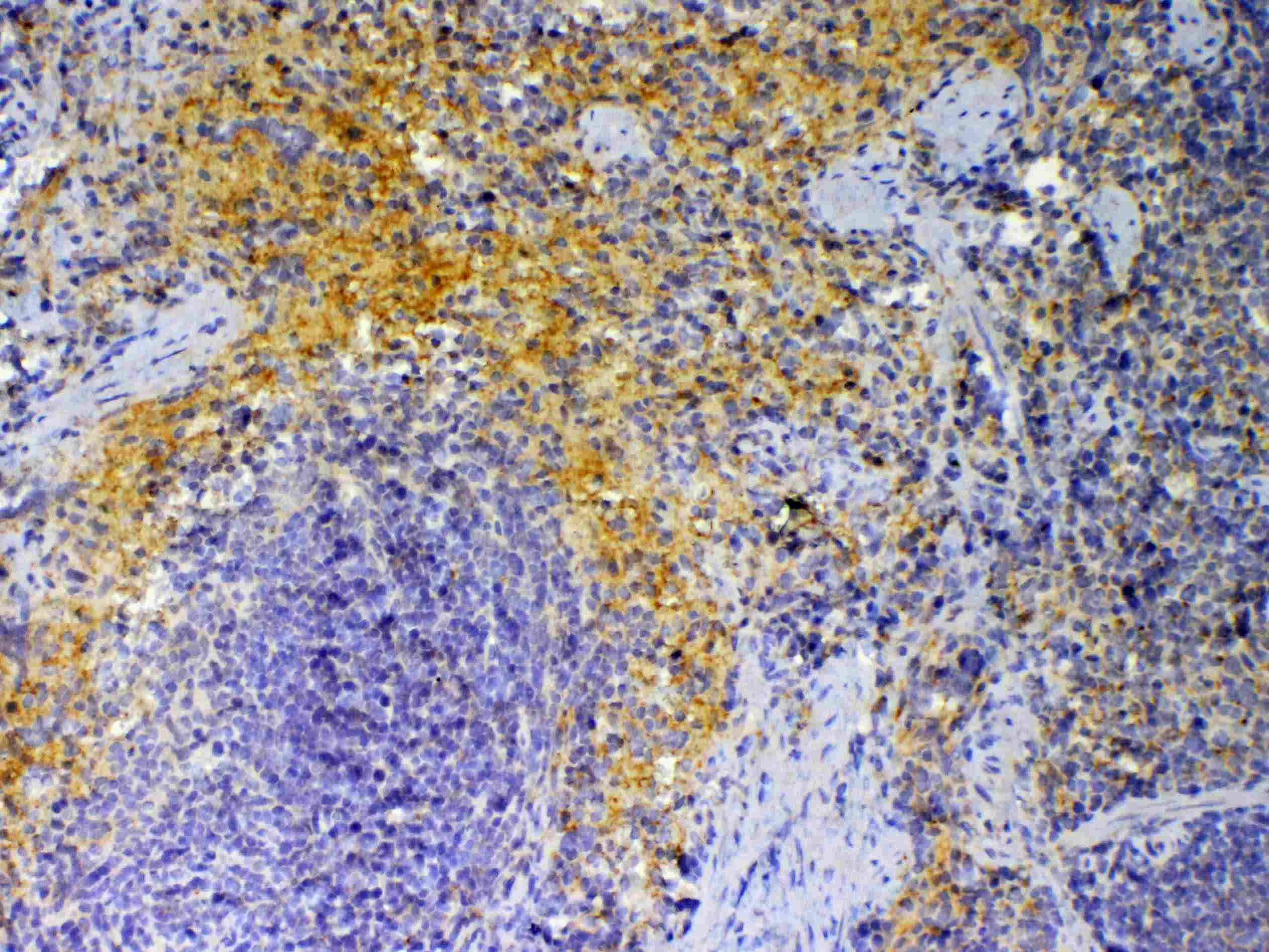 CXCL4 / PF4 Antibody