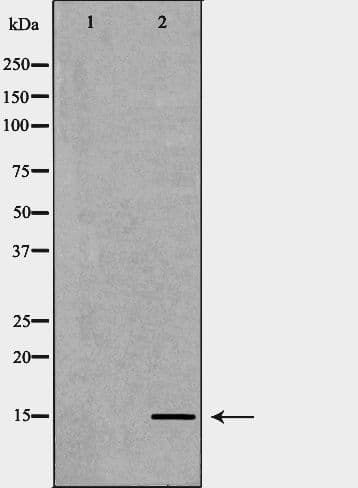 TAC1 Antibody