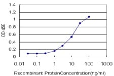 IHC-plus™ TAOK2 / TAO2 Antibody (clone 2E2)