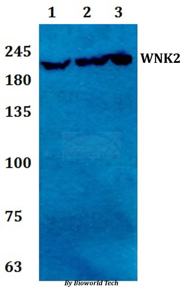 Polyclonal Rabbit anti-Human WNK2 Antibody (WB)