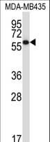 PDIA5 / PDIR Antibody (aa488-517)